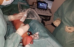 kirurg za krčne žile