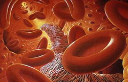 Neavaren zaplet krčnih žil je strdek Strdek v krčnih žilah je zaplet krčnih žil.